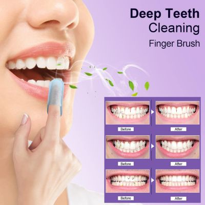 100pcs Teeth Wipes Disposal Finger Brush Deep Cleaning Teeth Wipes Oral Brush Up Tooth Wipes  for Teeth Cleaning, Mint Flavor