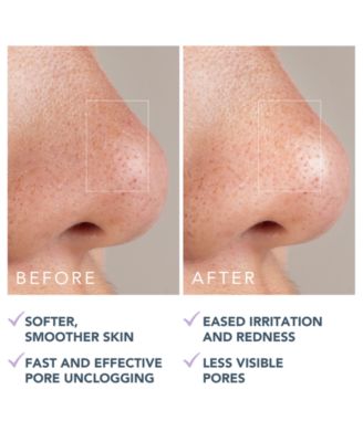 Kiwi Active Pore Blackhead Mask 100g