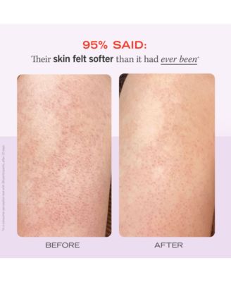 KP Bump Eraser Body Scrub With 10% AHA - Fresh Strawberry, 2 oz.