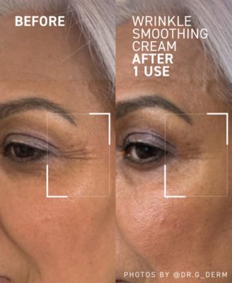 Instant Wrinkle Relaxing Cream, 0.5 oz.