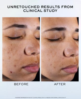 Clarifique Pro-Solution Brightening & Dark Spot Reducing Serum, 1.7 oz.