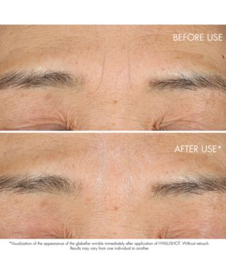 DIOR Capture Totale Hyalushot Wrinkle Corrector with