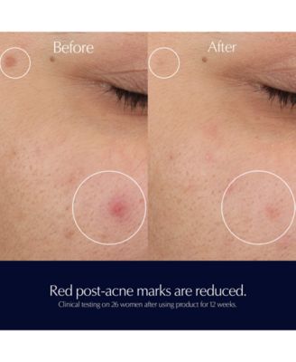 Advanced Night Repair Rescue Solution Serum with 15% Bifidus Ferment, 0.68 oz.