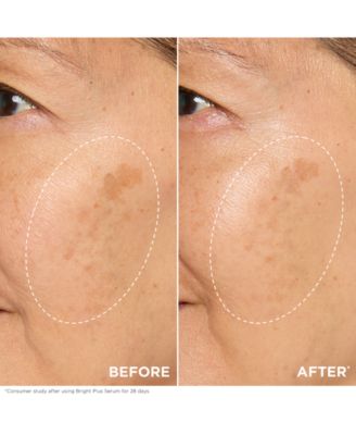 Bright Plus Brightening Vitamin C & Niacinamide Dark Spot Serum, 1 oz.