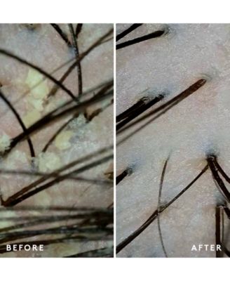 Scalp Remedy Conditioner, 6.7 oz.