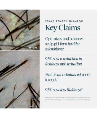 Scalp Remedy Shampoo, 8 oz.