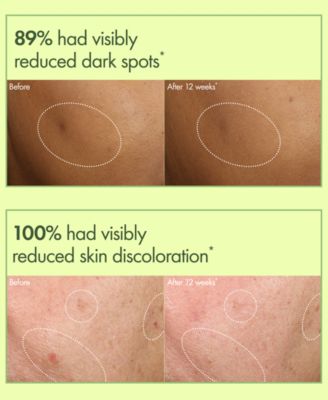 Mega-Mushroom Dark Spot Brightening Serum