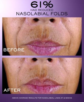 R&eacute;nergie C.R.x. Triple Serum Retinol, 1.7 oz. 