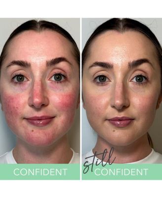 T.C.E. Color Correcting Green Cream