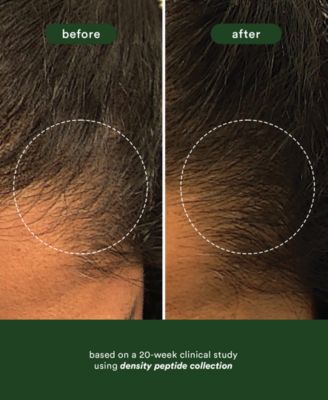 Density Peptide Hair Serum, 1 oz.