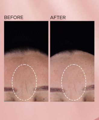 Retinol + HPR Ceramide Capsules Rapid Skin Renewing Serum, 60 capsules