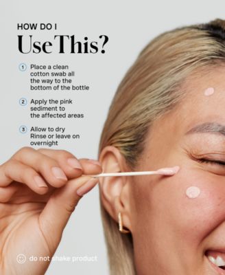 EradiKate Acne Treatment, 1 oz.