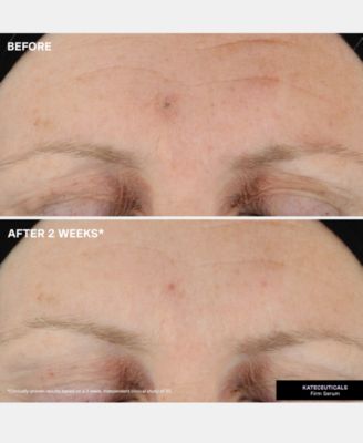 KateCeuticals Firming Serum, 1 oz.