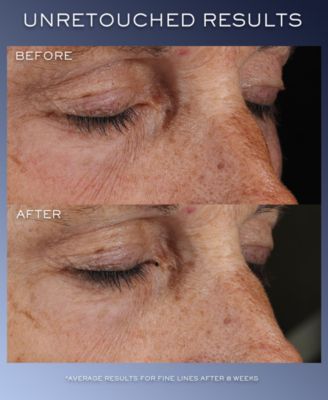 G&eacute;nifique Ultimate Eye Cream, 0.68 oz.