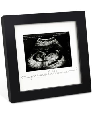 Solo Baby Sonogram Picture Frame, Modern Ultrasound Picture Frames, Pregnancy Announcements Sonogram Frame