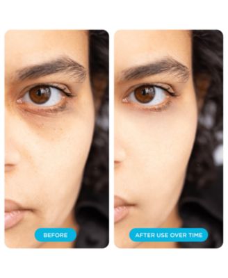 Depuffing Hyaluronic Acid Undereye Patches 48-Pack