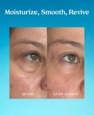 Ceramide & Retinol Dual-Core Eye Balm