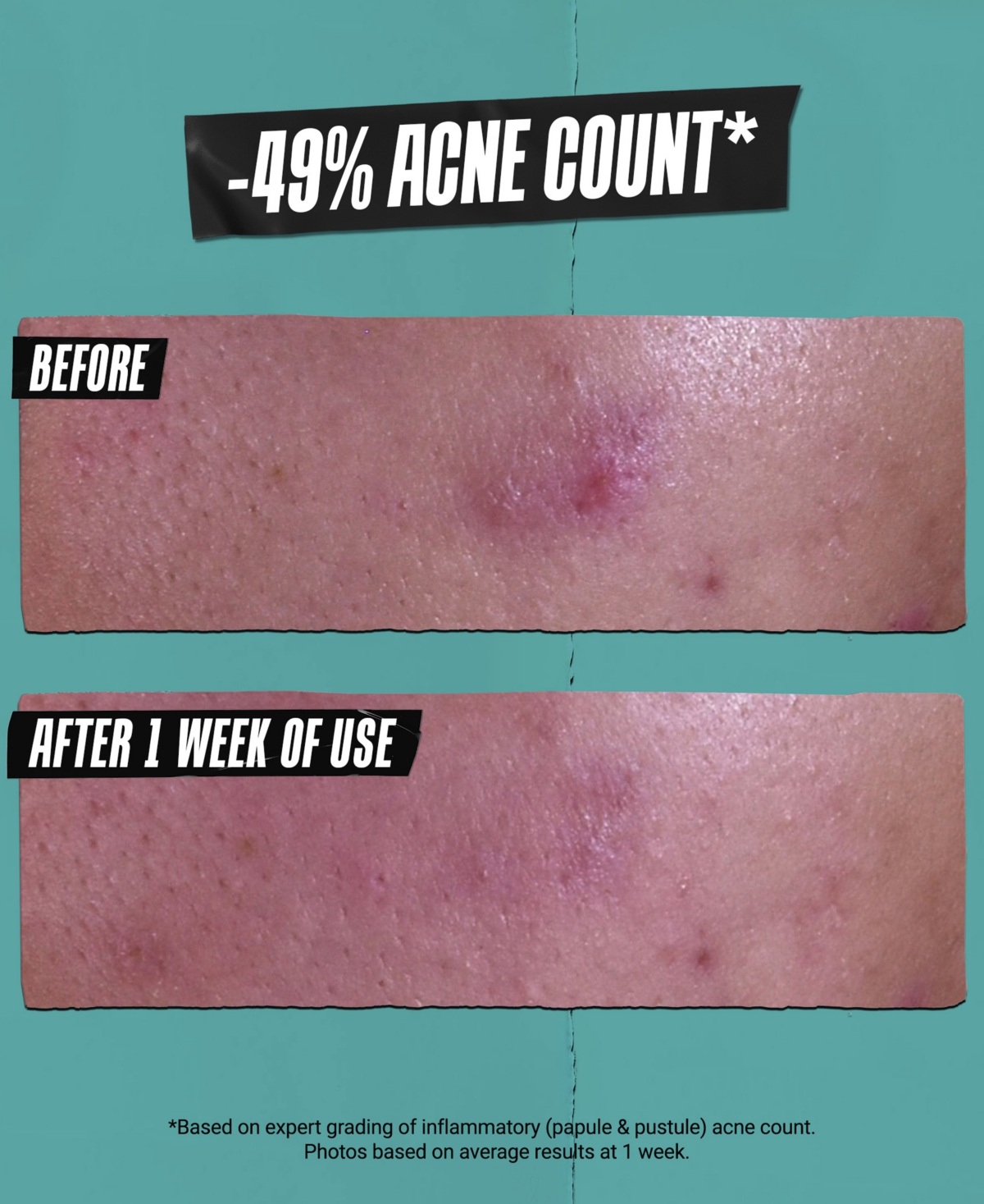 Kiehl's Since 1851 Gently Effective Acne-treating Cleansing Paste In Transparent