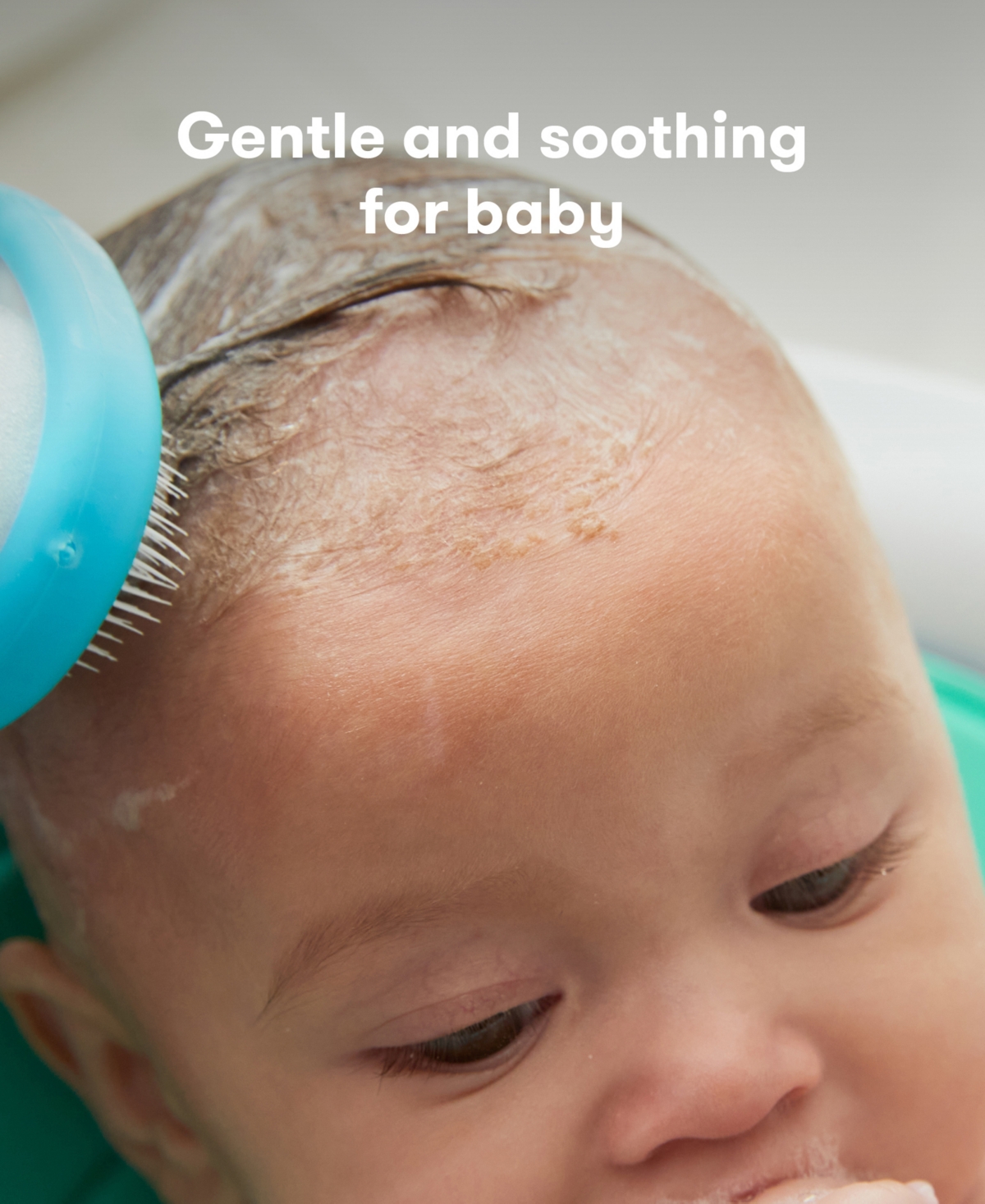 Frida Derma The Flakefixer The 3-step Cradle Cap System By Baby In White