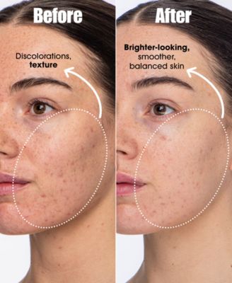 Detox Darling Pro-Microbiome, Balancing Essence For Oily & Blemish-Prone Skin, 1.7 oz.