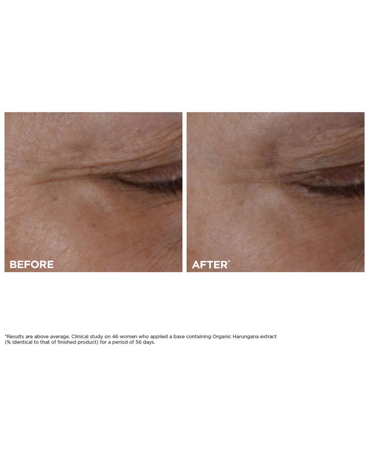 Clarins 3-pc. Total Eye Lift Set In Red
