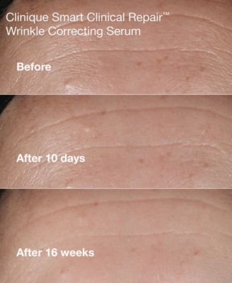 Day-To-Night Smart Clinical Repair Gift Set, Created for Macy's