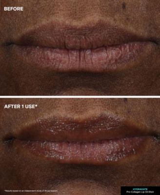 HydraKate Lip Oil Elixir, 0.24 oz.