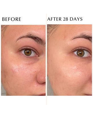 Excia Brightening Immaculate Serum Z