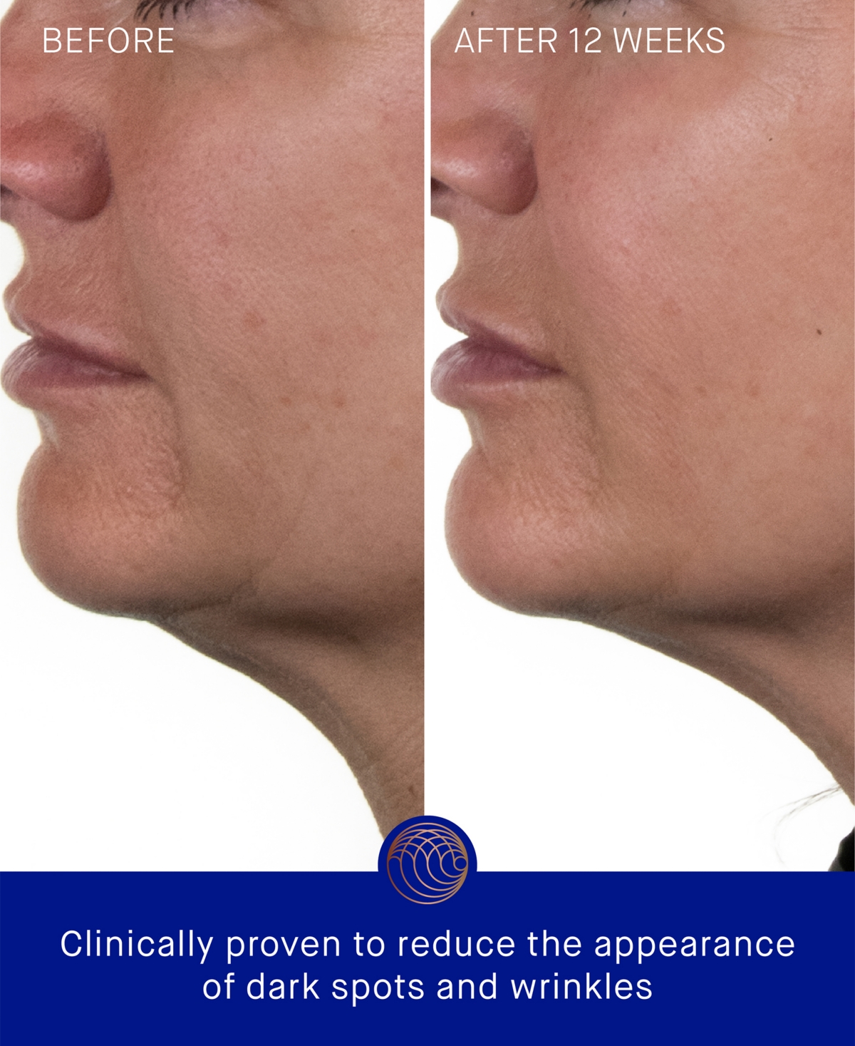 Augustinus Bader The Rich Cream, 3.38 oz