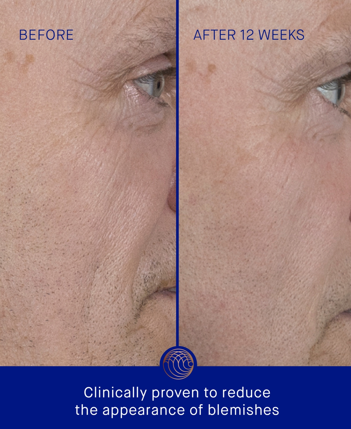 Augustinus Bader Mini The Serum, 1.01 oz.