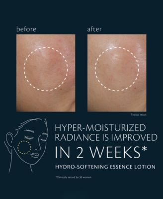 Hydro-Softening Essence Lotion, 5.7 oz.