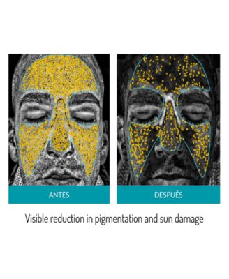 Mask LED Phototherapy Mask