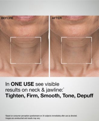 TL Advanced Sculpting Jawline and Neck Mask