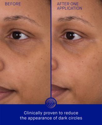 The Eye Patch Bundle, 3-Pack