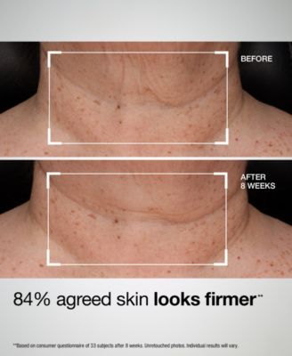 TL Advanced™ Tightening Neck and Chest Lotion Broad Spectrum SPF 35, 1.5 oz.