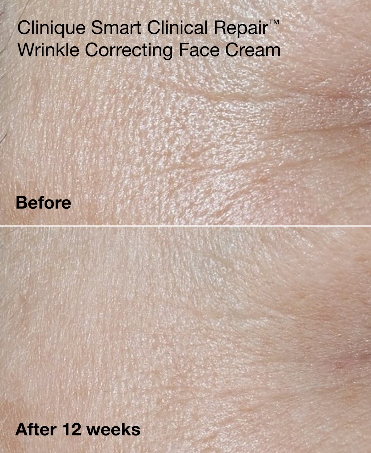 Clinique 3-Pc. Mini Smart Clinical Repair Skincare Set