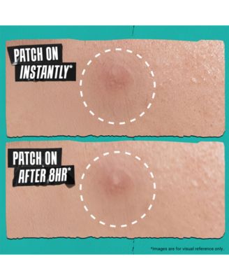 22-Pc. Acne Physical Patch Set