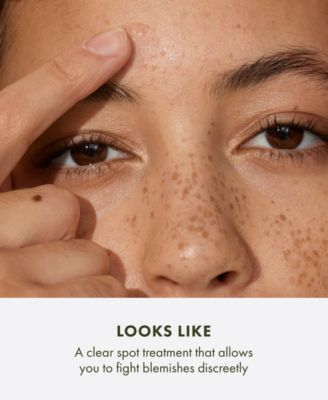 Super Spot Remover Acne Treatment Gel With Salicylic Acid, 0.3 oz.