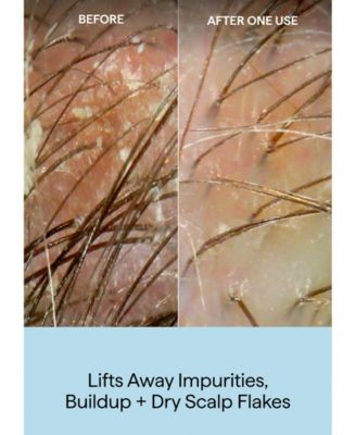 Scalp Revival Charcoal + Coconut Oil Exfoliating Shampoo, 8 oz.