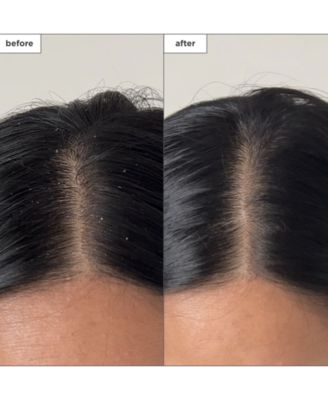 Scalp Revival Charcoal + Tea Tree Buildup Detox Spray, 4 oz.