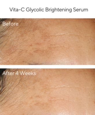 Murad 4-Pc. Brighten Trial Set