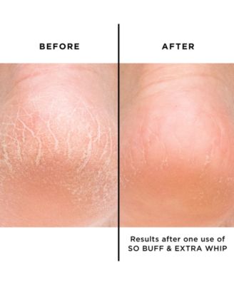 Extra Whip Hand & Foot Treatment With Shea Butter, 1-oz.