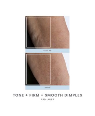 2-Pc. NuBODY Skin Toning Device Set