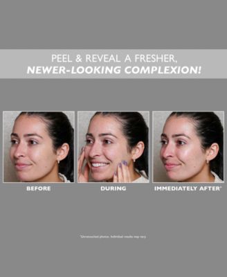 FIRMx Peeling Gel, 3.4 oz