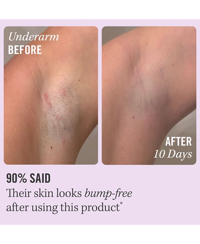 First Aid Beauty Ingrown Hair Pads With BHA & AHA, 60 Pads Macy's