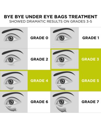 Bye Bye Under Eye Bags Daytime Treatment