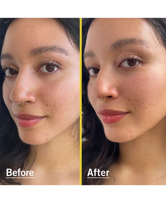 First Aid Beauty Weightless Liquid Mineral Sunscreen SPF 30, 1.5 oz