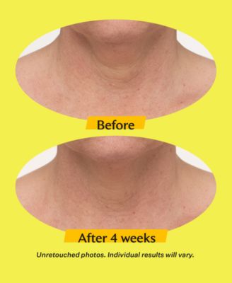 TL Advanced Tightening Neck Cream Plus With Alpha-3 Peptide, 1.7 oz.