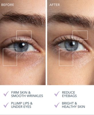 BEAR 2 eyes lips Microcurrent Line Smoothing Device