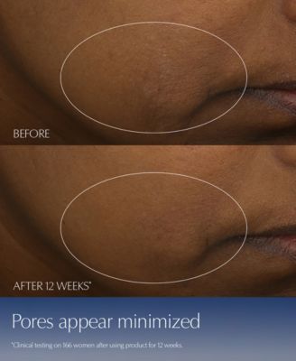 Estée Lauder Limited-Edition Advanced Night Repair Synchronized Multi-Recovery Complex Serum, 1.7 oz.